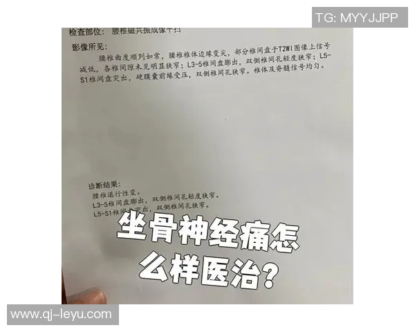 专家解读坐骨神经痛成因及治疗方法大多数患者可避免手术治疗